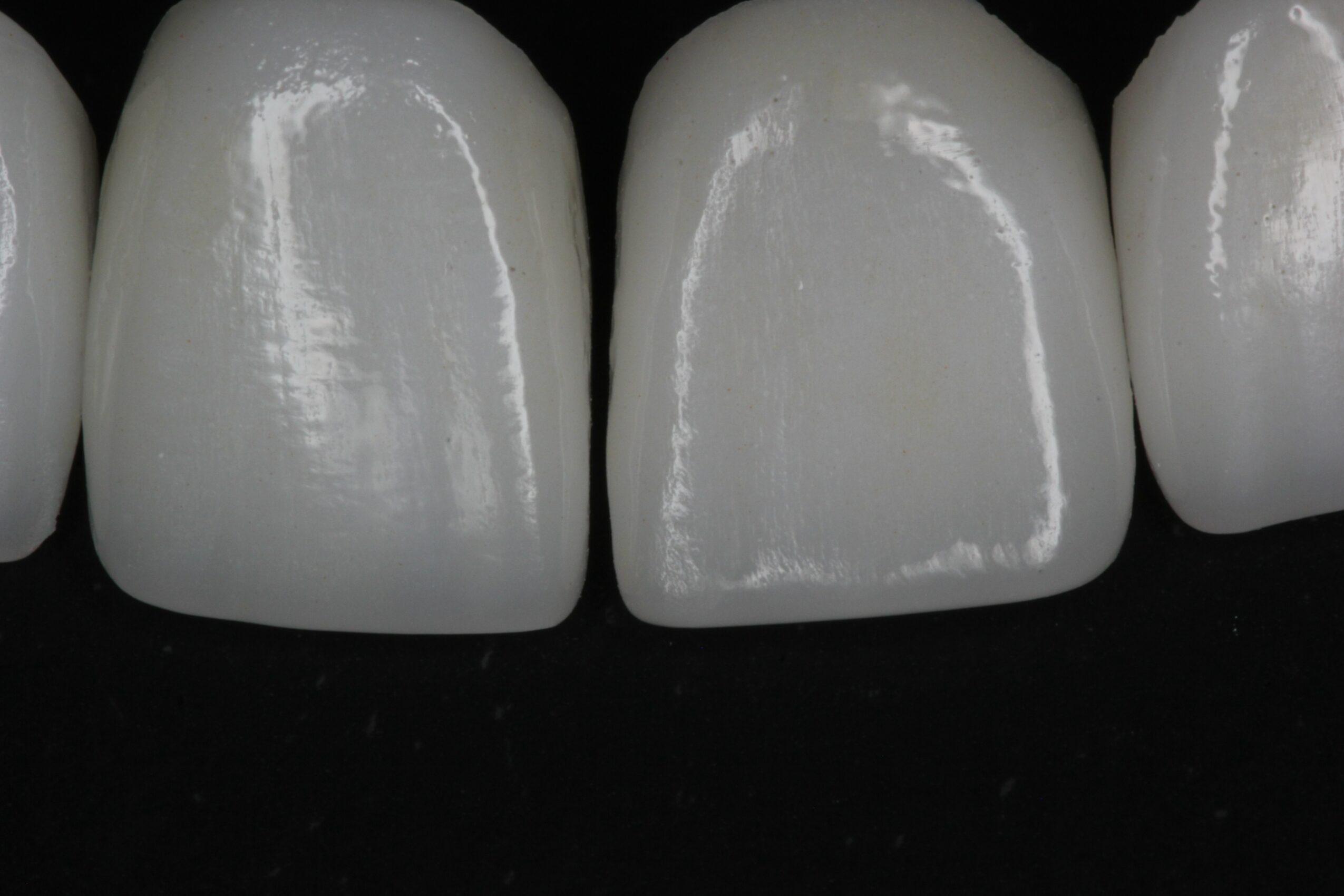 Close-up of four white dental crowns or veneers on a black background.