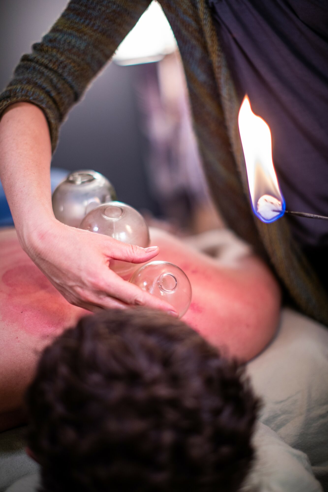 Person holding glass cups over a person's back during a therapy session, with a lit candle nearby.