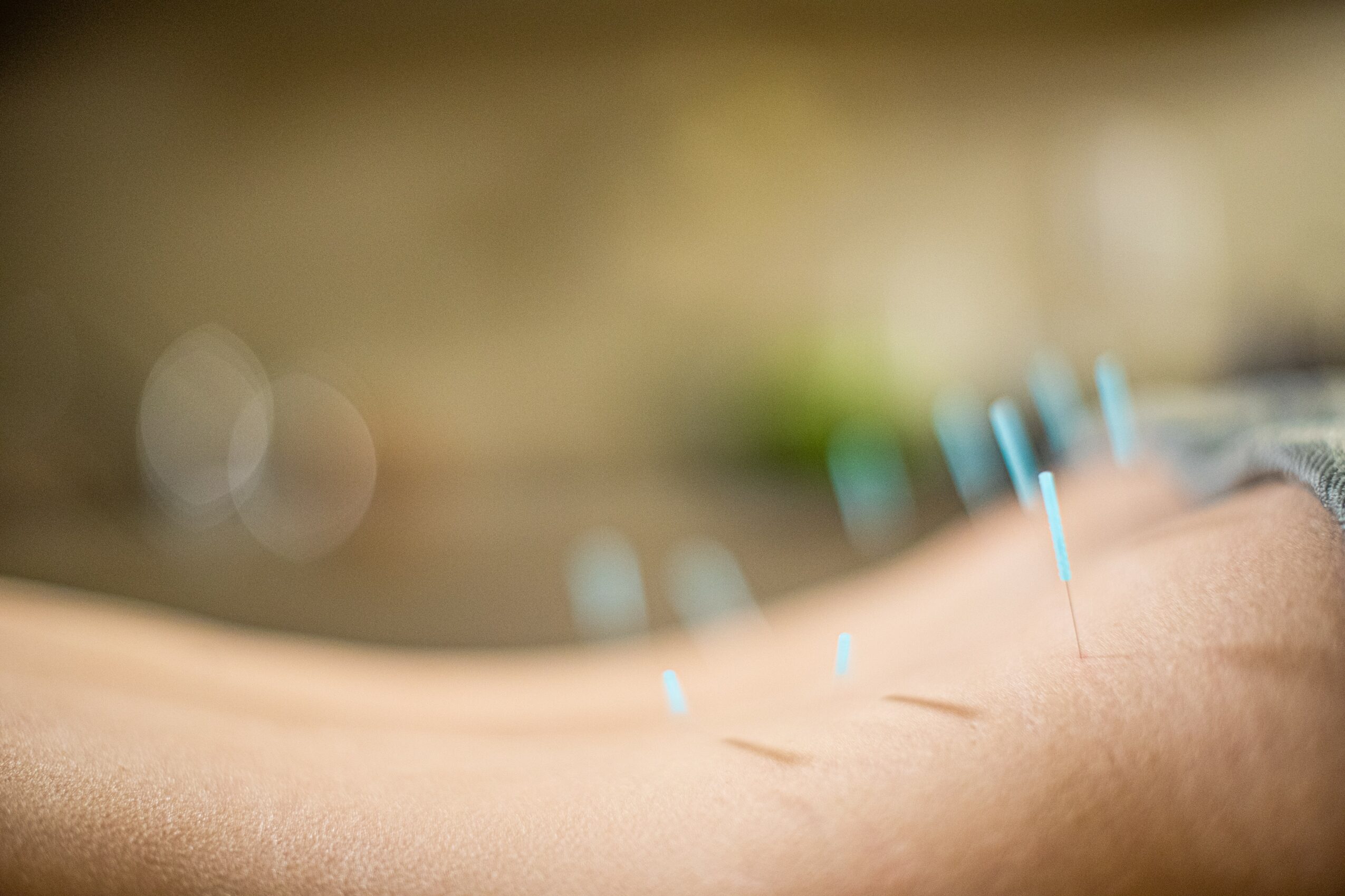 Close-up of a person's arm with small cuts, blurred background, and a neutral tone.